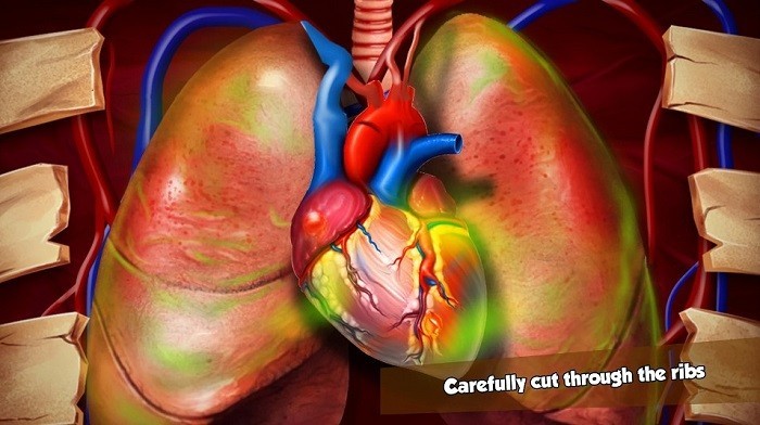 心脏手术2023最新下载