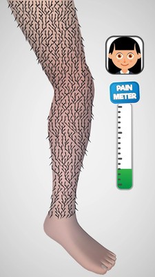 脱毛大师免费版