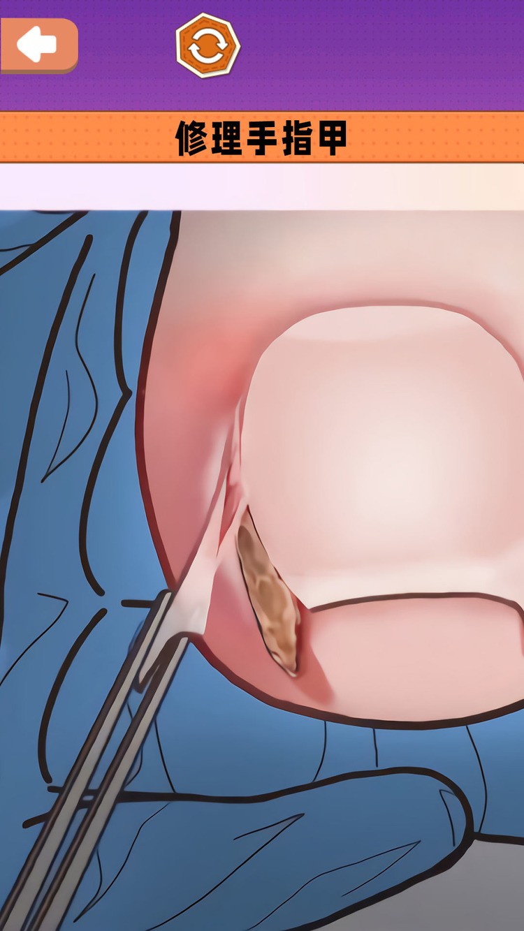 沉浸式采耳修脚游戏安卓版